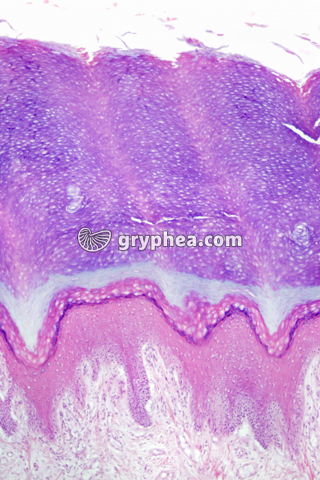 Peau du doigt fortement kératinisée CT x25 - gryphea.org